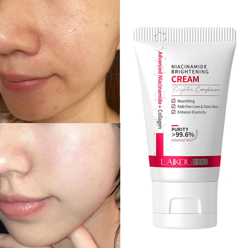 Niacinamide Whitening Cream